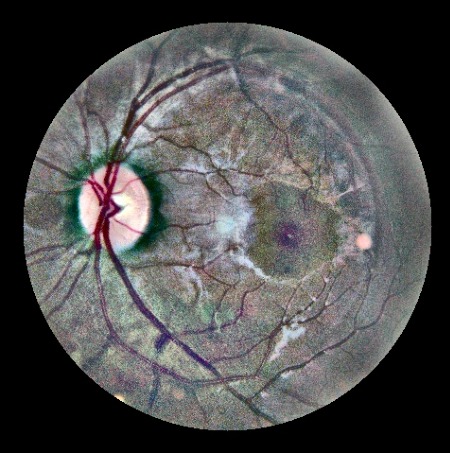 Example color fundus photograph